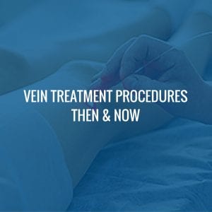 Vein Treatment Procedures Then & Now
